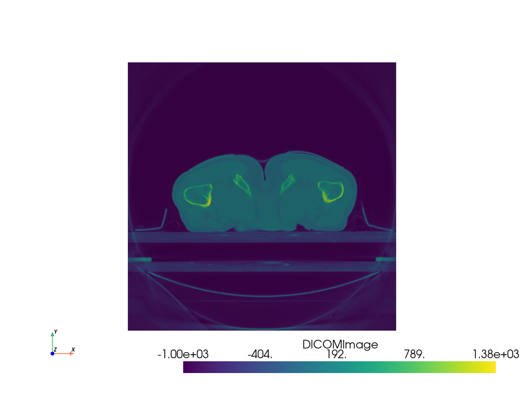 ../../_images/pyvista-examples-downloads-download_prostate-2c6ca69db2a61e02_00_00.png