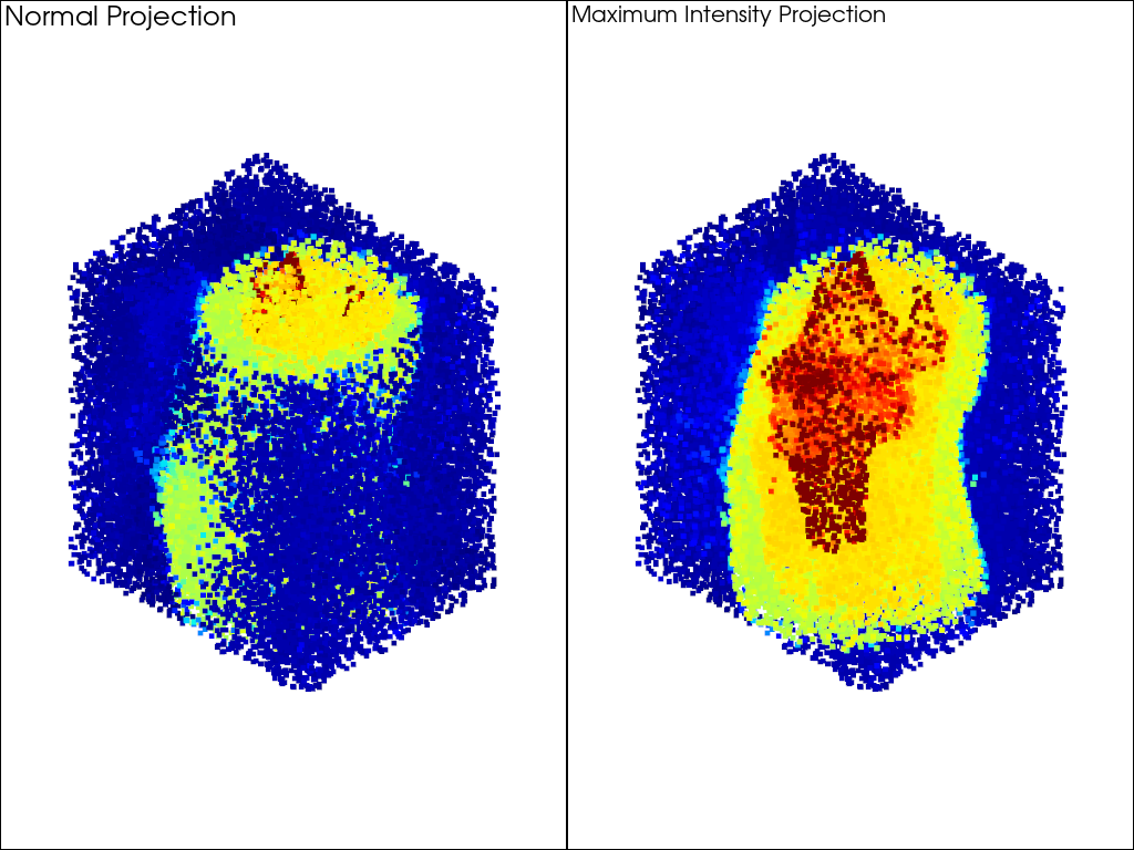 maximum intensity projection