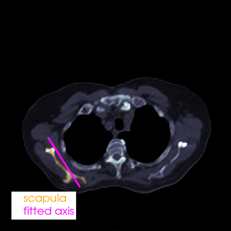 slice oblique anatomy