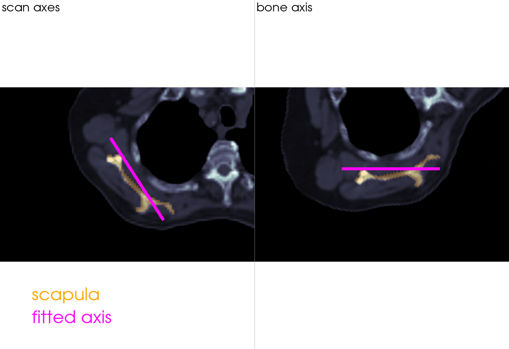 slice oblique anatomy