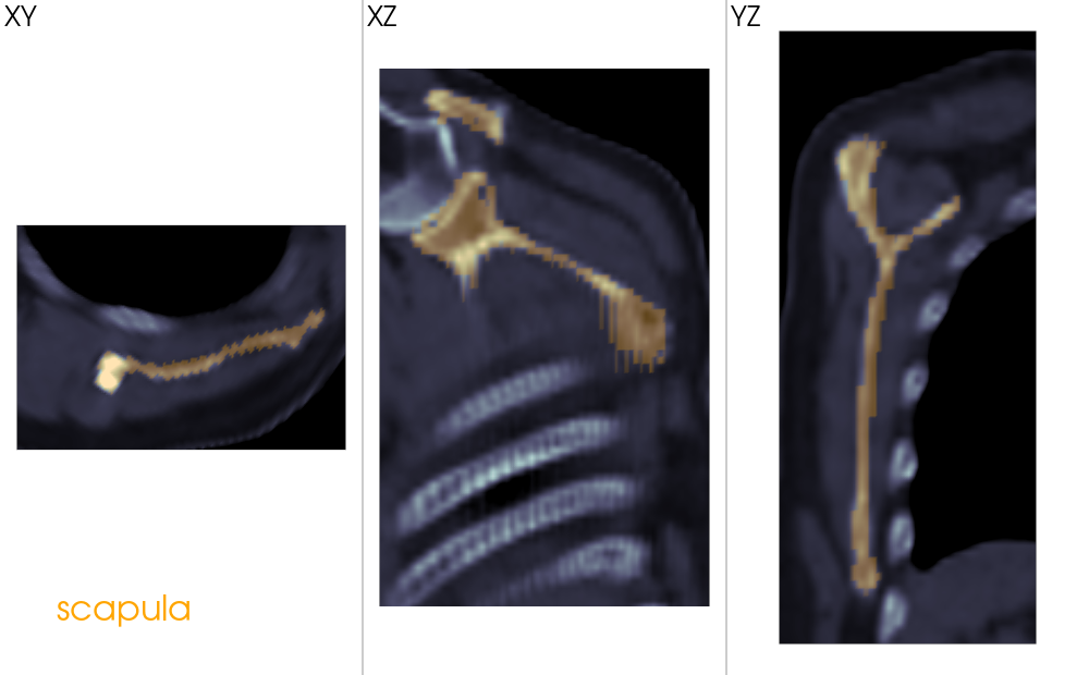 slice oblique anatomy
