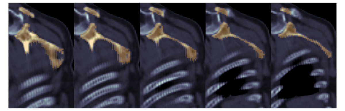 slice oblique anatomy
